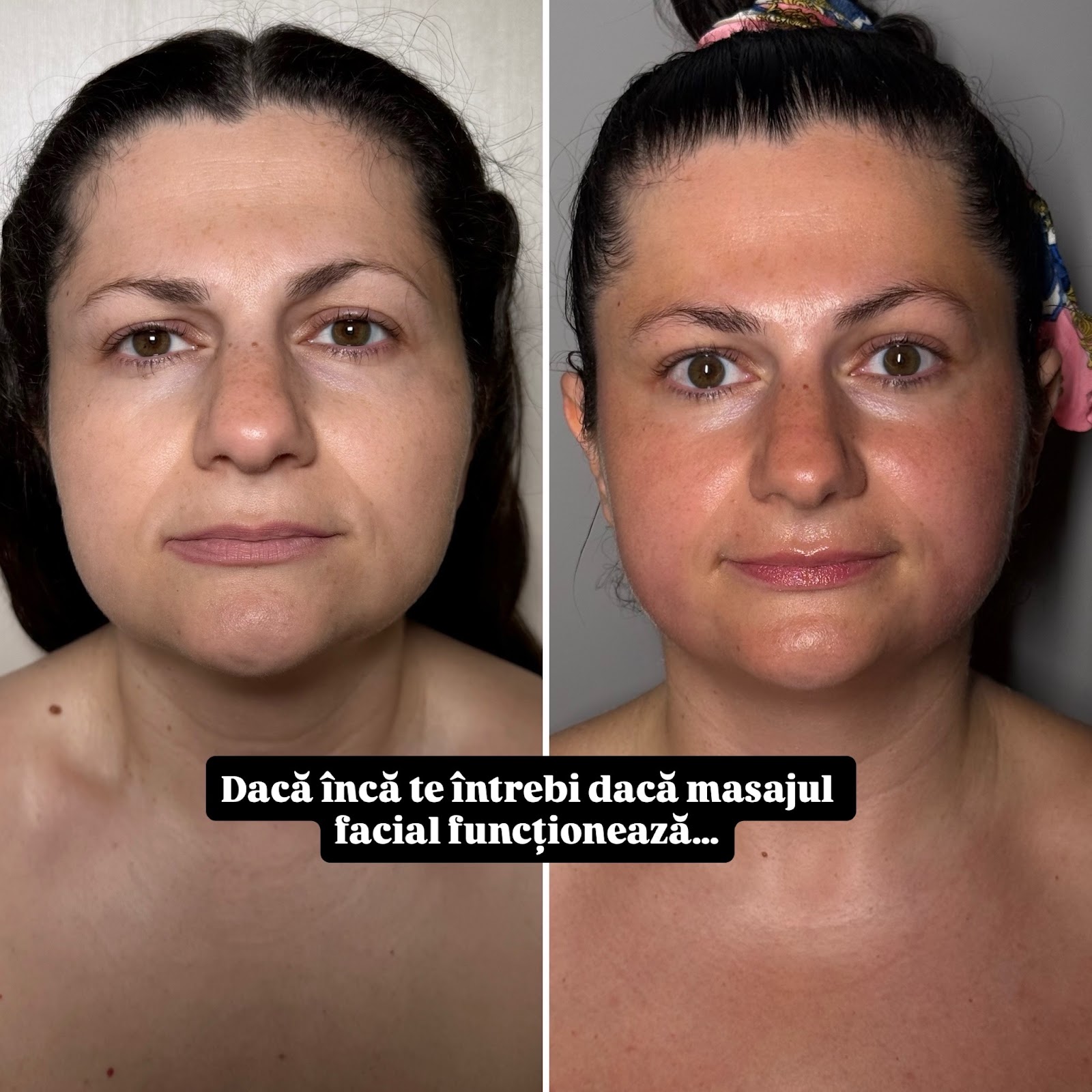 BeautyFly SkinCare by Laura Ștefan