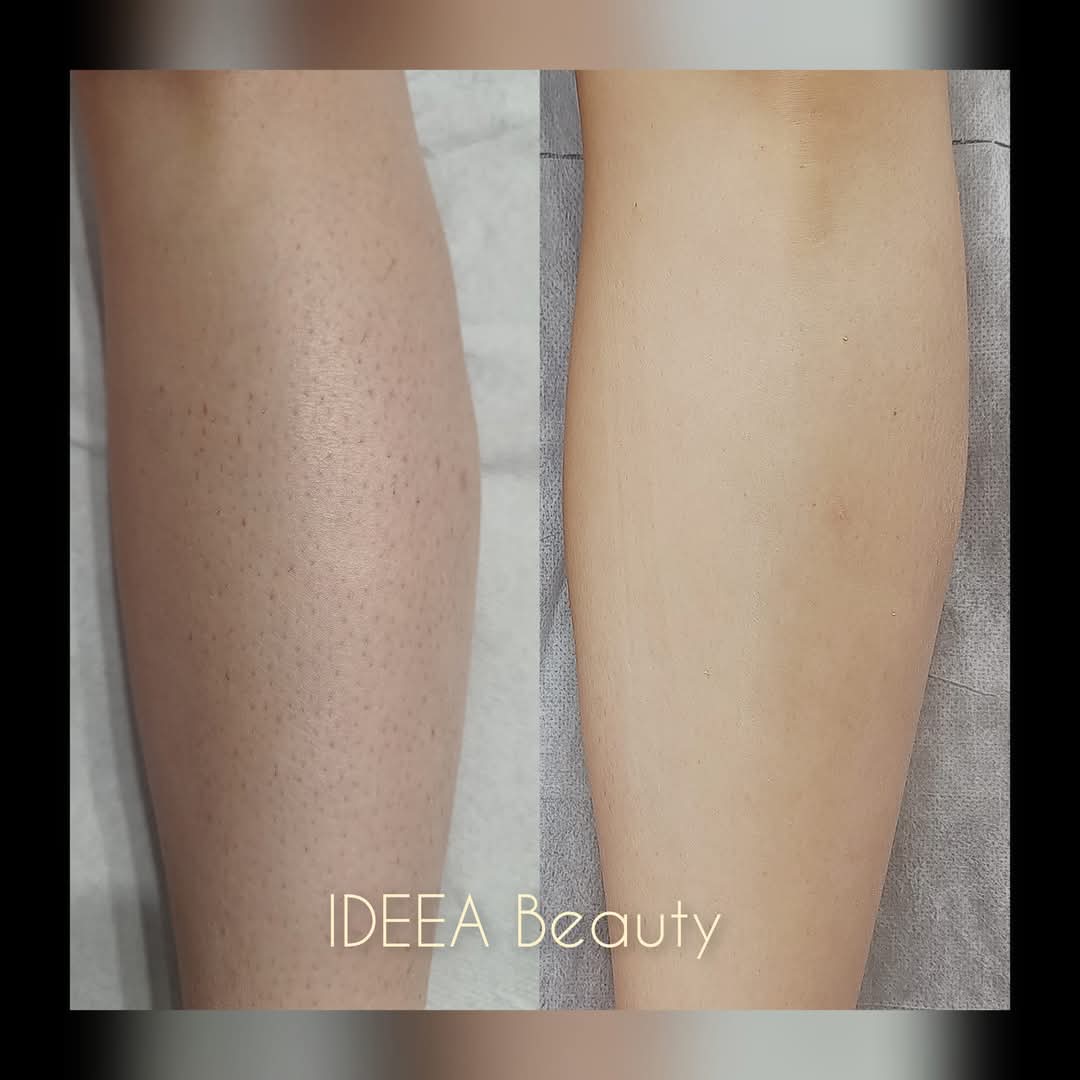 IDEEA BEAUTY