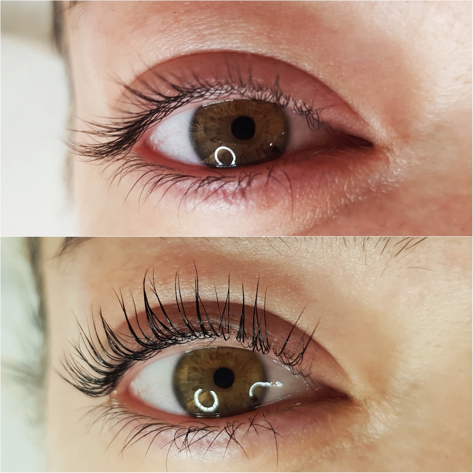 G Beauty Center|Centru de estetica faciala si corporala