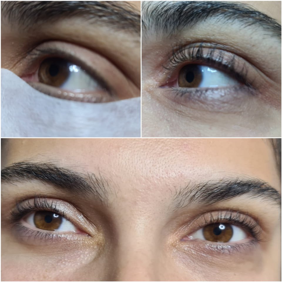 Anca Cosmetics Studio - Tratamente faciale profesionale, Epilare definitivă, Epilare cu laser, Servicii de cosmetică, Brașov