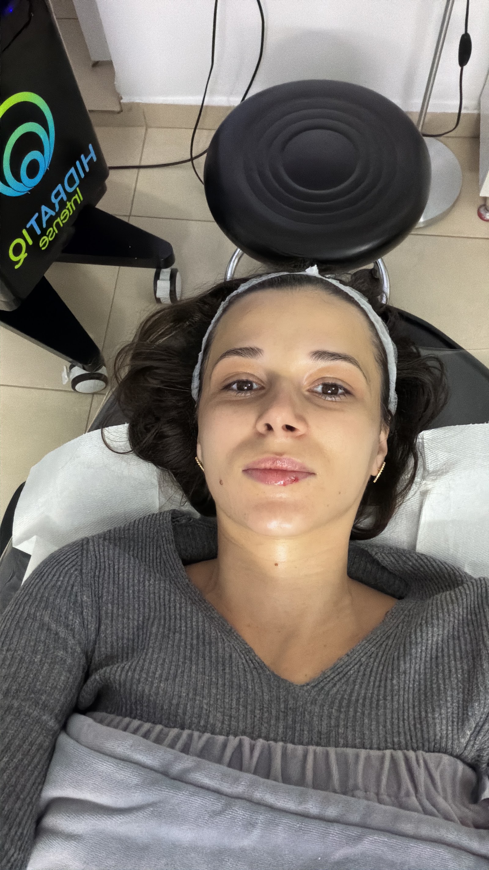 Epilare Definitivă - Imagen Beauty Salon