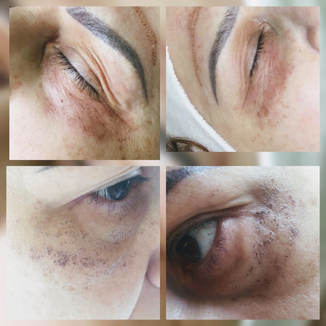 Adrett Beauty Med