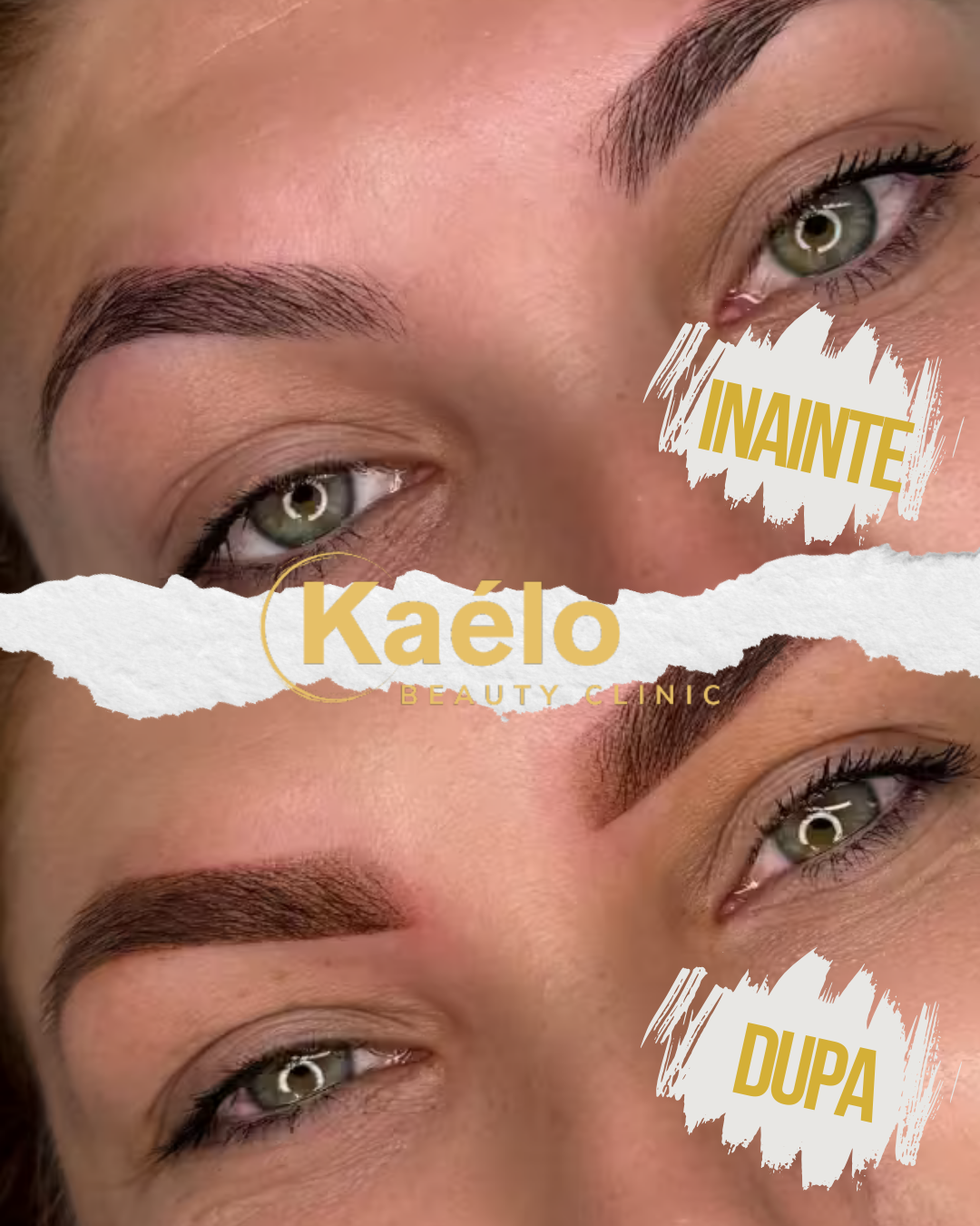 Kaelo Beauty Clinic - Clinică de Estetică, Remodelare & Epilare Buzău