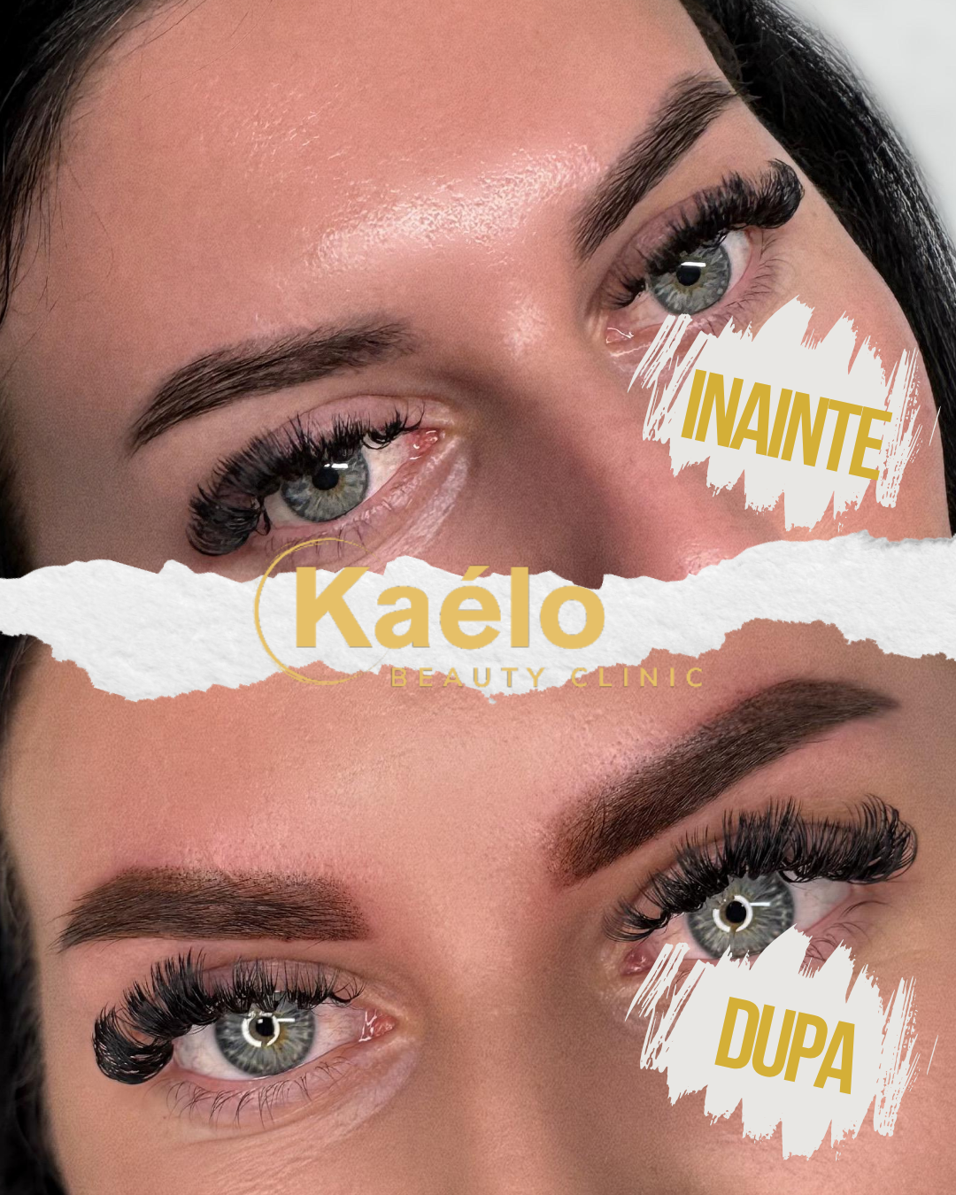 Kaelo Beauty Clinic - Clinică de Estetică, Remodelare & Epilare Buzău